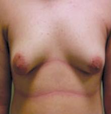 Male Cosmetic Surgery before 0