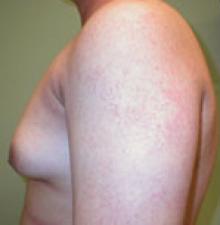 Male Cosmetic Surgery before 1