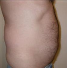 Male Cosmetic Surgery before 1