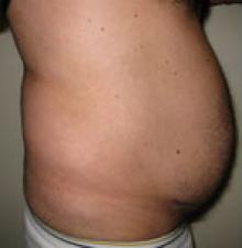 Male Cosmetic Surgery before 1