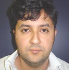 Male Cosmetic Surgery before 3