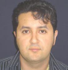 Male Cosmetic Surgery after 3