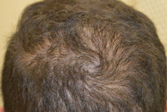 Male Cosmetic Surgery before 4
