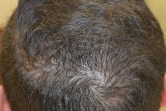 Male Cosmetic Surgery after 4