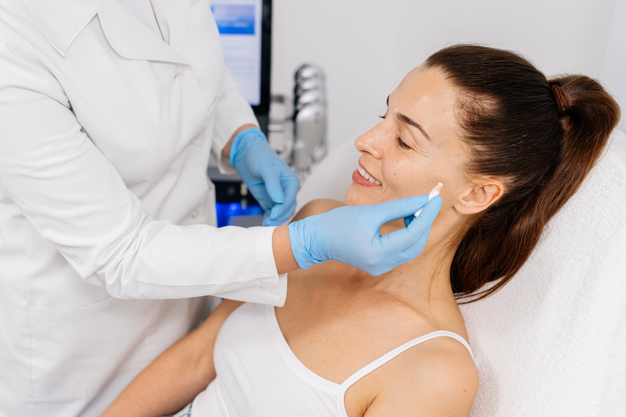 InstaLift thread lift facial marking before treatment