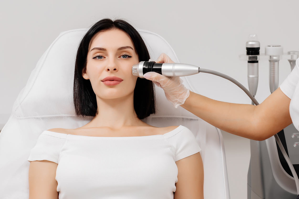 Profound RF skin tightening treatment to cheek