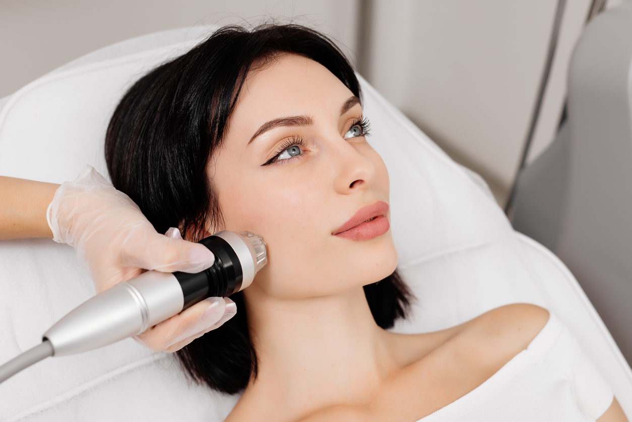 RF microneedling treatment with handheld device
